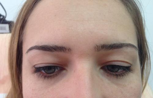 Процедура: межресничное пространство и стрелка. 02