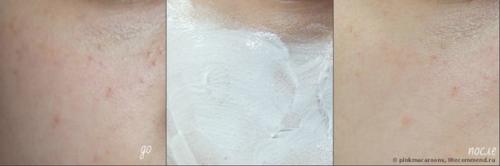 В наличии!  Легендарная массажная маска! 05