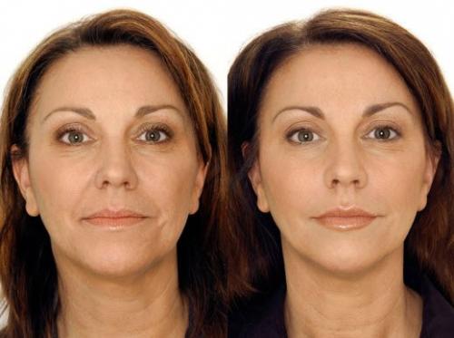 Годы долой!  Макияж с лифтинг - эффектом: 01 Годы долой!  Макияж с лифтинг - эффектом: 01