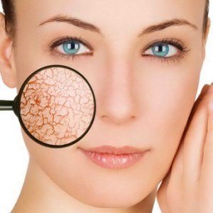 Полезные советы: Уход за сухой кожей лица.