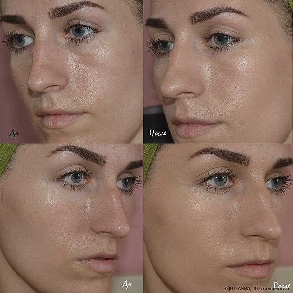 Похоже на то, что эпохе ВВ-кремов. 02