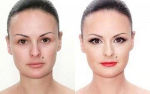 Почему после перманентного татуажа или пластической операции появилась асимметрия? 02 Почему после перманентного татуажа или пластической операции появилась асимметрия? 02