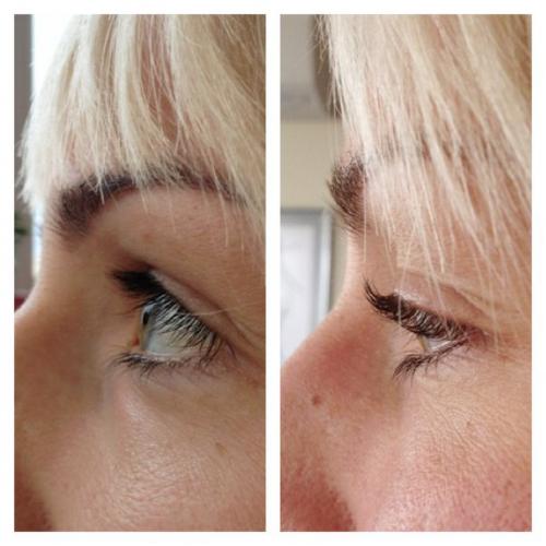 Красивые ресницы - мечта каждой женщины. 01