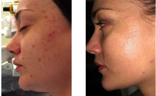 Сегодня день пилинга! 03 Сегодня день пилинга! 03