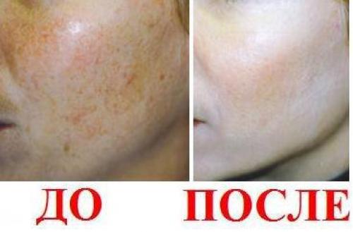 Сегодня день пилинга! 02 Сегодня день пилинга! 02