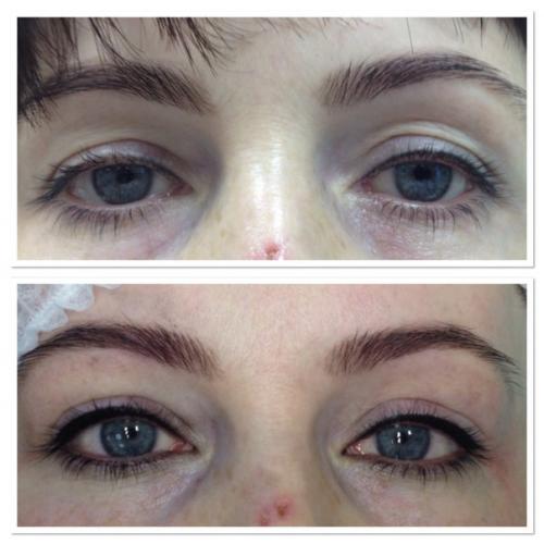 Милые дамы, отвечаю на ваши вопросы! 01