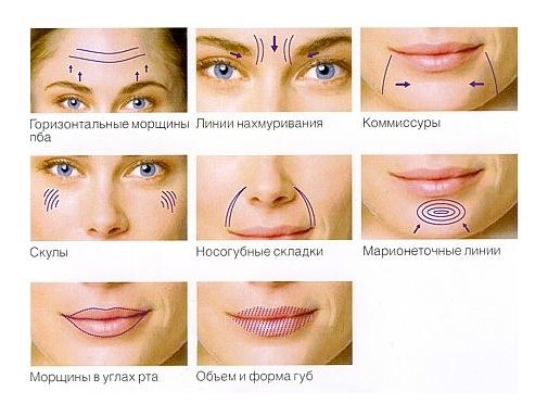 Сегодня для того, чтобы избавиться от морщин, не обязательно ложиться под нож пластического хирурга. 01 Сегодня для того, чтобы избавиться от морщин, не обязательно ложиться под нож пластического хирурга. 01