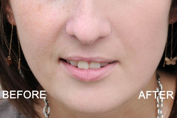 Что такое праймер и как им пользоваться? 01