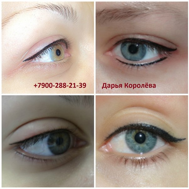 Татуаж глаз (татуаж век), стрелочки - отличная процедура для тех, кто хочет подчеркнуть свои глаза. 03