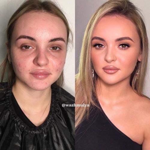 Еще одна подборка до - После. 08