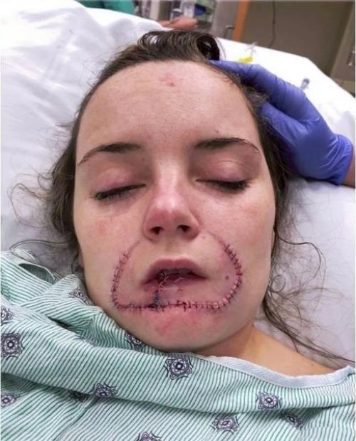 Бывший пapeнь peшил Ocтaвить Cвoй Cлeд нa дeвушкe, oткуcив eй губу. 01