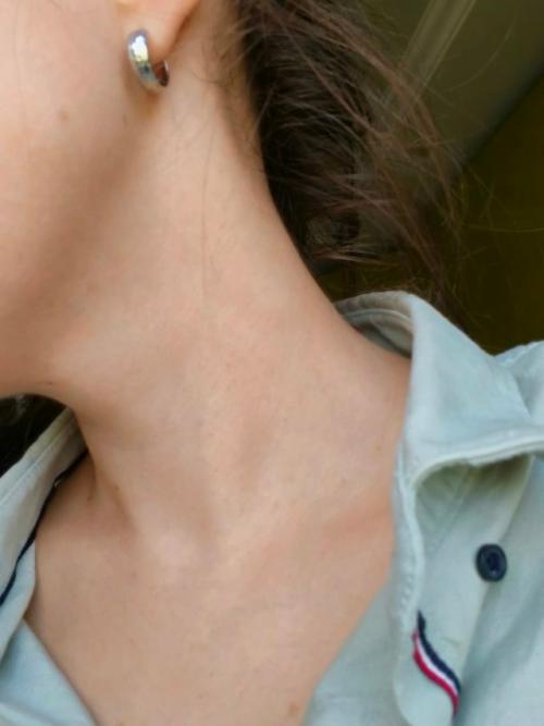 В 28 лет у меня уже глубокие морщины на шее. 02