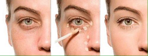 Любимые девочки?  Сегодня мы с вами тему консилеров затронем? 03