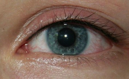 Межресничный татуаж глаз. 03 Межресничный татуаж глаз. 03