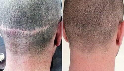 Запись на перманентный макияж? 07 Запись на перманентный макияж? 07