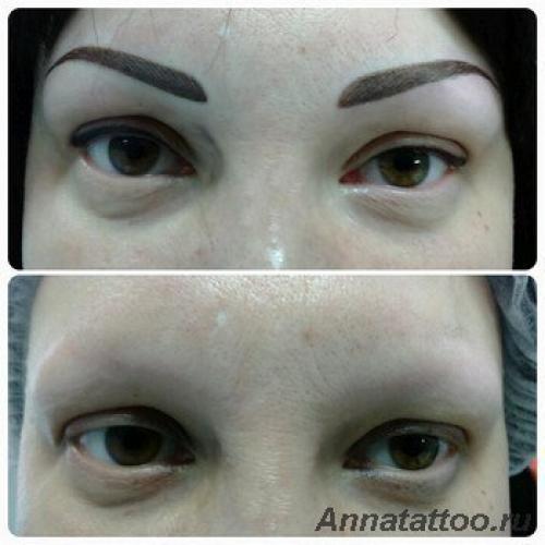 Что делать, если из бровей и век выпадают волоски? 01 Что делать, если из бровей и век выпадают волоски? 01