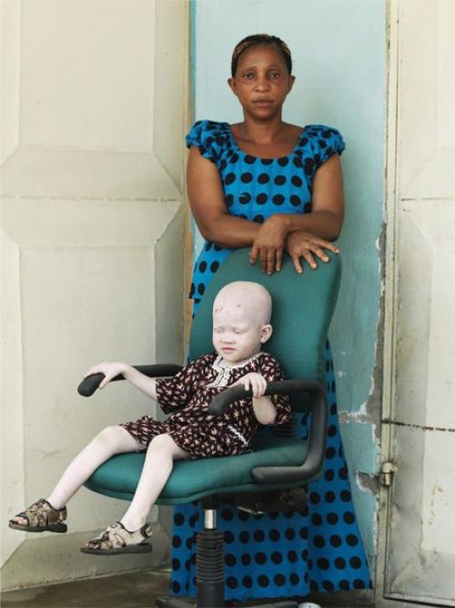 Не/видимые. Белые африканцы. 02 Не/видимые. Белые африканцы. 02