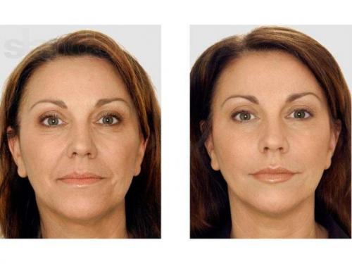 Косметика серии Zhenfei Perfect корпорации Tiande рекомендована для использования с 35-летнего возраста. 01