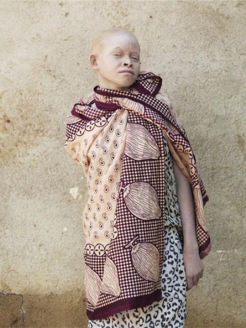 Не/видимые. Белые африканцы. 03 Не/видимые. Белые африканцы. 03