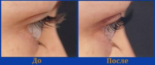 Биозавивка ресниц является не только весьма эффективной, но и совершенно безболезненной процедурой. 03 Биозавивка ресниц является не только весьма эффективной, но и совершенно безболезненной процедурой. 03