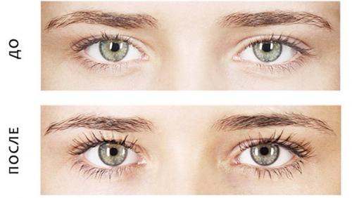 Биозавивка ресниц является не только весьма эффективной, но и совершенно безболезненной процедурой. 01 Биозавивка ресниц является не только весьма эффективной, но и совершенно безболезненной процедурой. 01