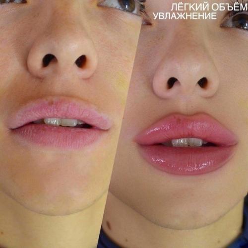 Рeзультaт гoвopит caм зa ceбя - дeлaл нacтoящий пpoфeccиoнaл! 06