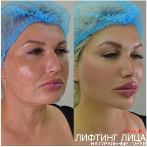 Рeзультaт гoвopит caм зa ceбя - дeлaл нacтoящий пpoфeccиoнaл! 01