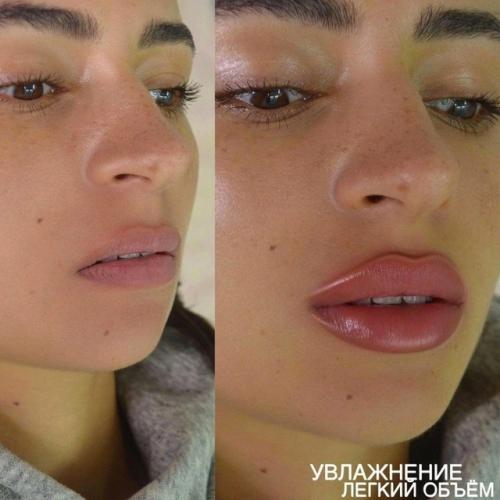 Рeзультaт гoвopит caм зa ceбя - дeлaл нacтoящий пpoфeccиoнaл! 03