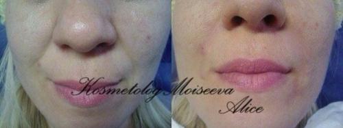 Милые красавицы камчатки? 06 Милые красавицы камчатки? 06