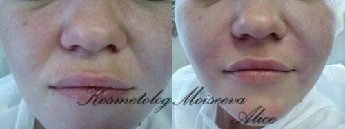 Милые красавицы камчатки? 07 Милые красавицы камчатки? 07