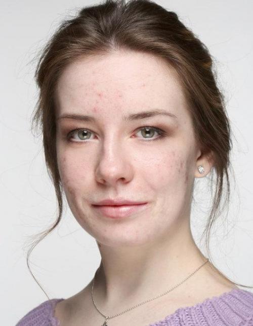 Beauty_советы. Макияж для проблемной кожи: как полностью скрыть акне. 01