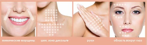 Что такое биоревитализация.