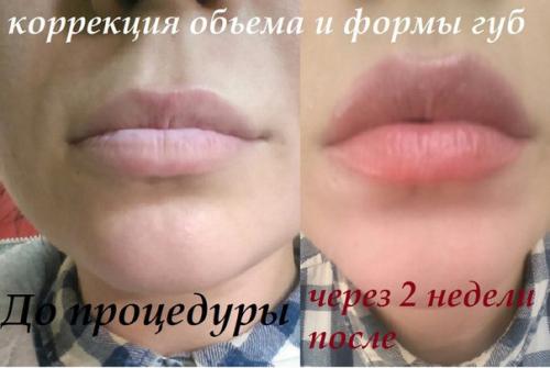 Модель на ТАТУАЖ ищу! 05