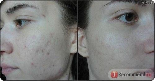 В наличии!  Это нереально эффективный крем! 100. 02