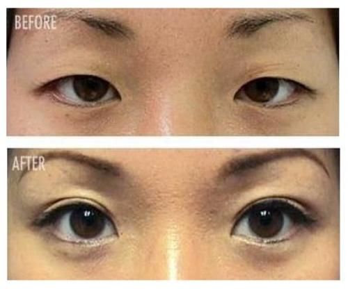 Культ красоты в Корее? 01 Культ красоты в Корее? 01