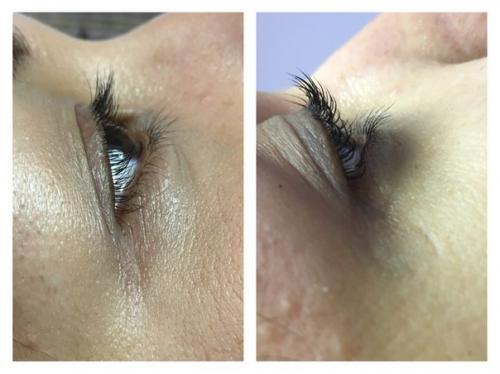 Вся правда о ламинировании ресниц.