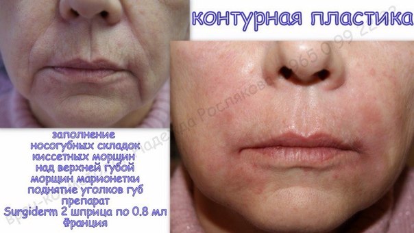 Акция. Акция. Акция. Милые девушки. 12 и 28 февраля. 01 Акция. Акция. Акция. Милые девушки. 12 и 28 февраля. 01
