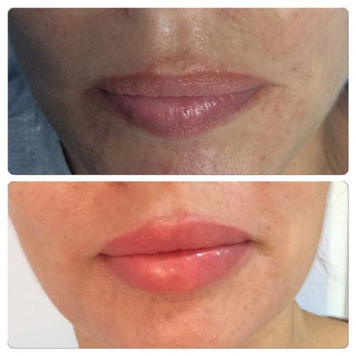 Перманентный макияж бровей позволяет скорректировать форму, цвет и размер бровей. 04