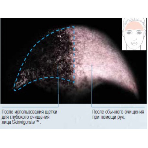 Щетка ДЛЯ Глубокого Очищения Лица Skinvigorate™. 01