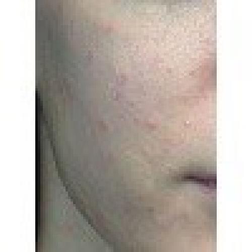 В наличии?  Оттенок Light, универсальный. 03