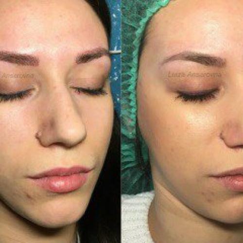 Специально для клиентов клиники Academica из города Санкт-петербург приезжает 29 мая 2016 г лучший специалист по перманентному макияжу. 01 Специально для клиентов клиники Academica из города Санкт-петербург приезжает 29 мая 2016 г лучший специалист по перманентному макияжу. 01