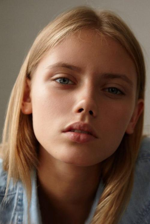 В светлое будущее: 5 способов быстро избавиться от темных кругов под глазами? 01 В светлое будущее: 5 способов быстро избавиться от темных кругов под глазами? 01