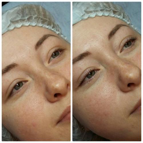 Модель?  Ламинирование ламинирование ресниц?  всего 3 дня? 01