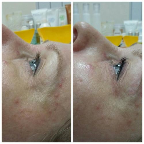 Модель?  Ламинирование ламинирование ресниц?  всего 3 дня? 04