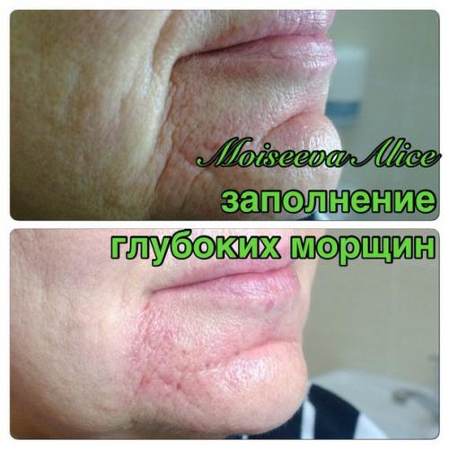 Милые красавицы камчатки? 04