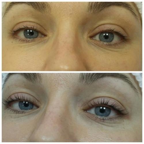 Модель?  Ламинирование ламинирование ресниц?  всего 3 дня? 02