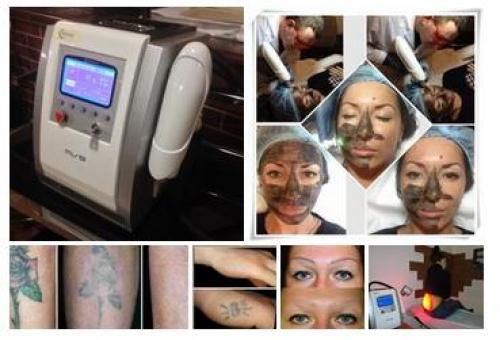 Наш неодимовый лазер для удаления та ту и татуажа! 05