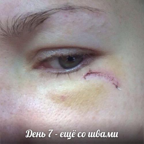 Средство которое должно в каждом доме быть! 05