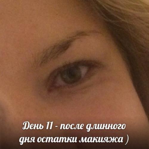 Средство которое должно в каждом доме быть! 08