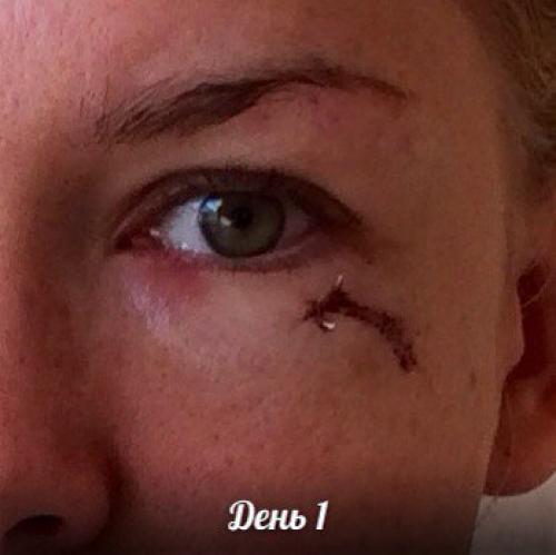 Средство которое должно в каждом доме быть! 02